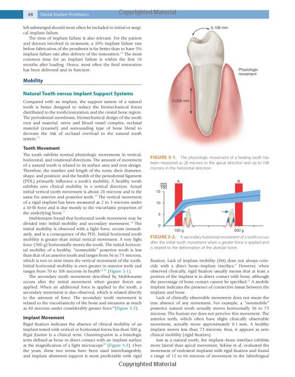 Dental Implant Prosthetics