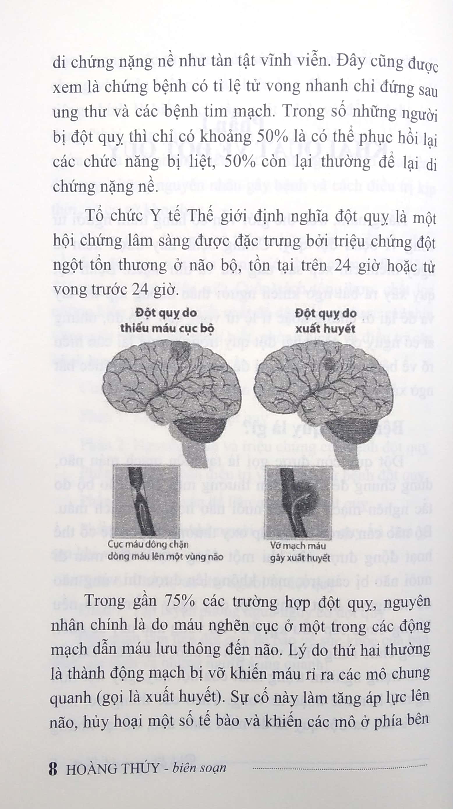 Bệnh Đột Quỵ Và Cách Điều Trị PDF đọc ebook online, epub online, nghe sách nói audio miễn phí.