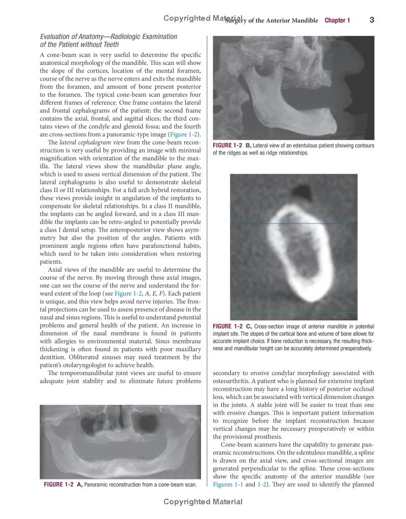 Color Atlas of Dental Implant Surgery
